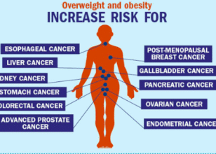 10 Cancers Associated with Obesity