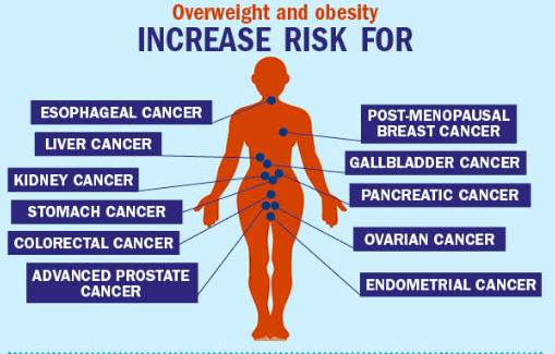 10 Cancers Associated with Obesity