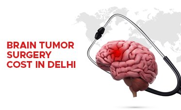 Brain Tumour Treatment in Delhi