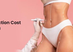 Liposuction Surgery cost in India
