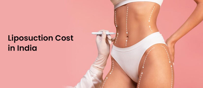 Liposuction Surgery cost in India