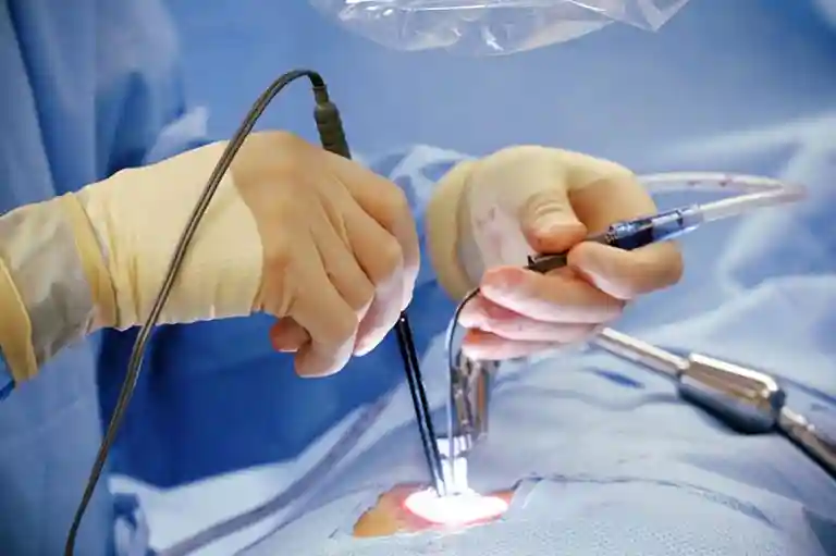 General Surgery