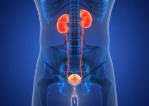 Kidney Transplant: A Hope for End-Stage Renal Disease (ESRD)