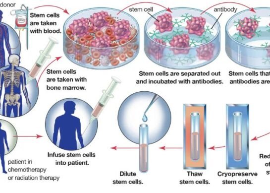 Greffe de moelle osseuse en Inde avec Mcure Health | Des soins de pointe à un prix abordable