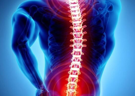 Mcure Health | Spine & Scoliosis Surgery In India