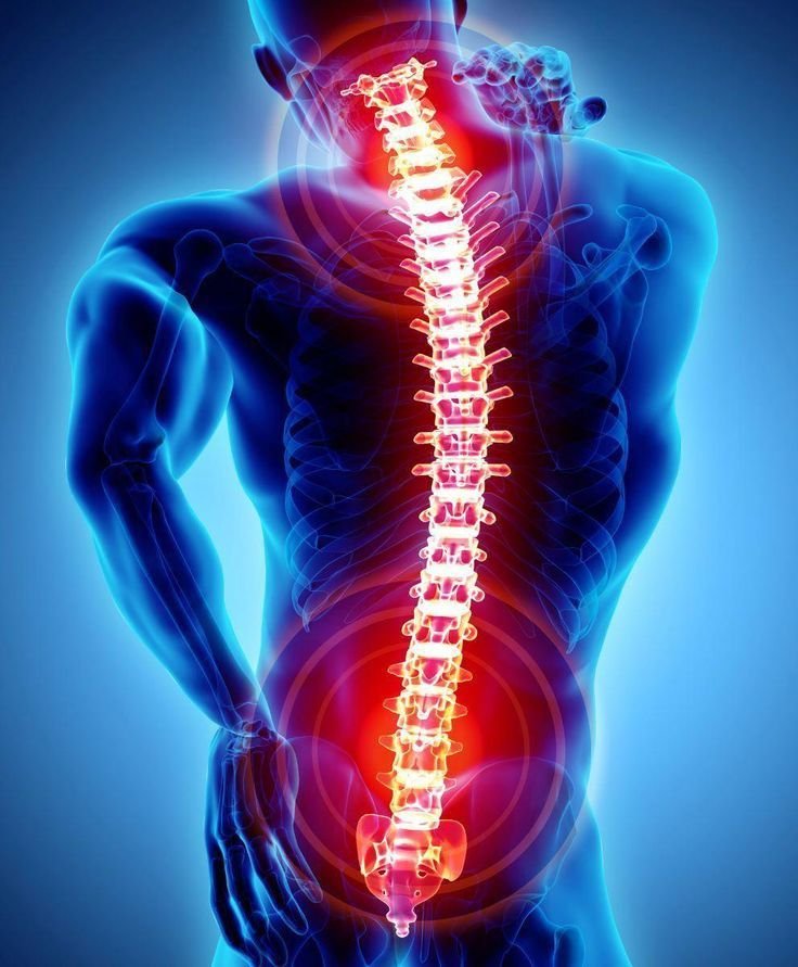 Mcure Health | Spine & Scoliosis Surgery In India