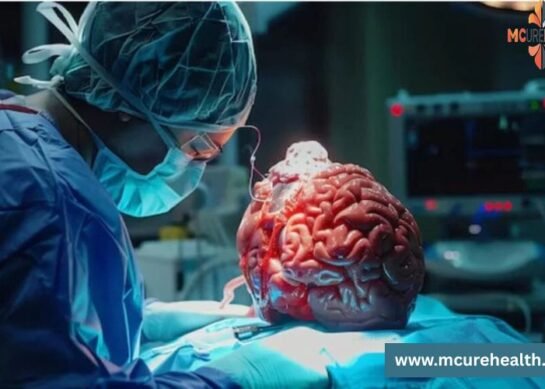Brain Tumor Surgery in Delhi, India with Mcure Health