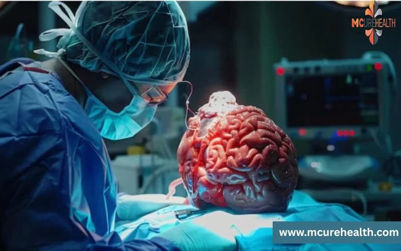 Brain Tumor Surgery in Delhi, India with Mcure Health
