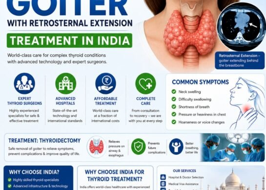 Mcure Health | Multinodular Goiter with Retrosternal Extension Treatment in India 